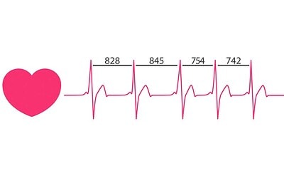 Apua uupuneelle mielelle ja keholle